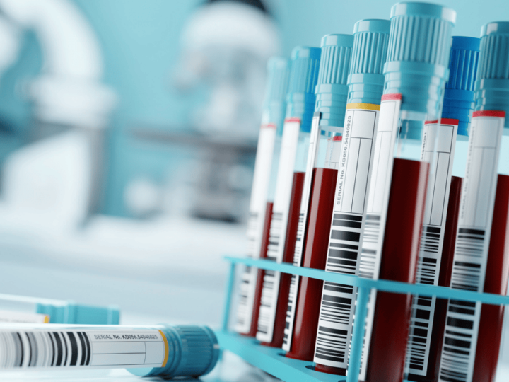 New Blood Test Offers Early Detection of Drug-Induced Tissue Damage in Cancer Patients